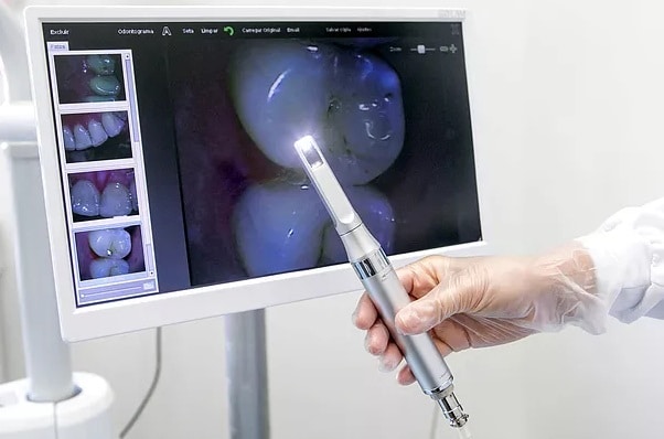 Odontologia: check-up digital é novidade em nome da prevenção