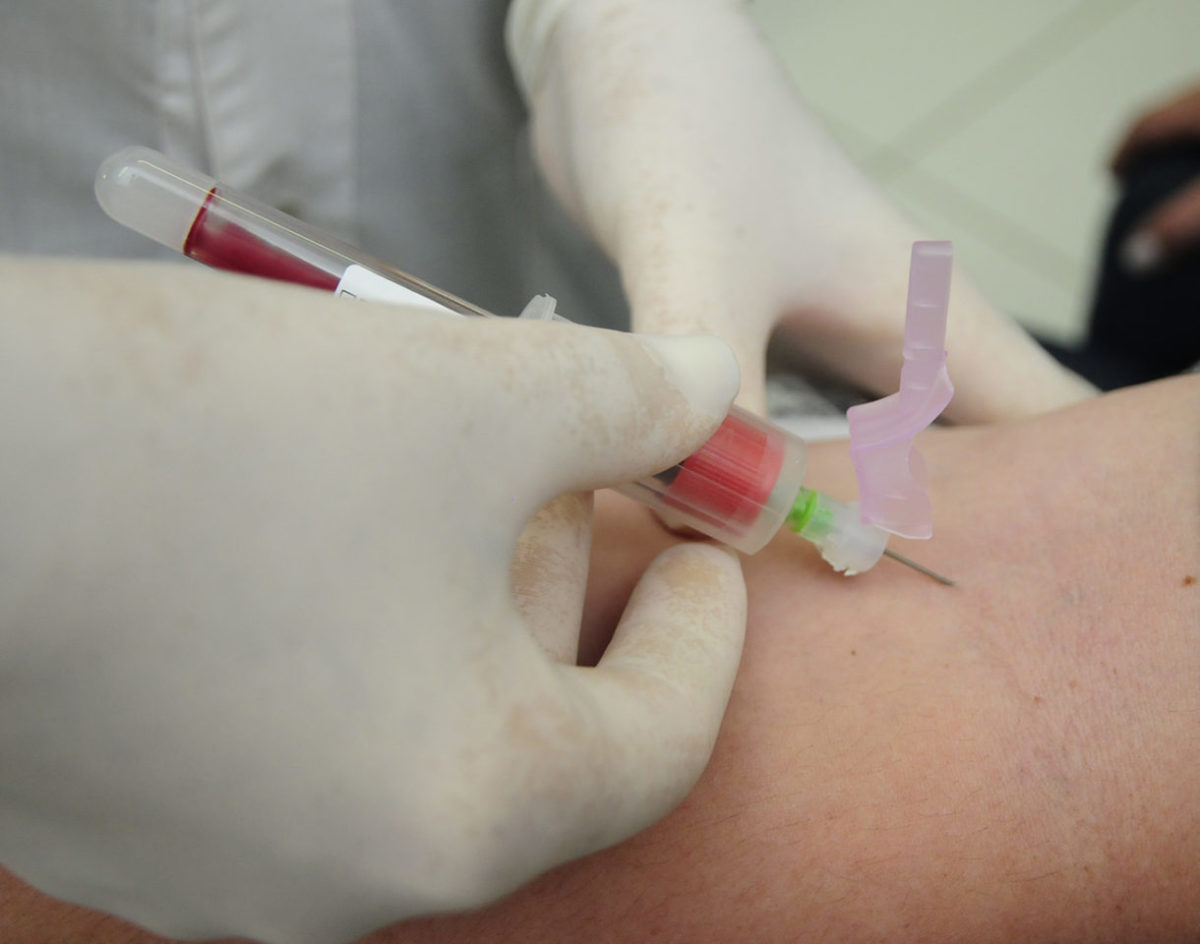 Positivo informado por laboratório particular espera por contraprova na cidade