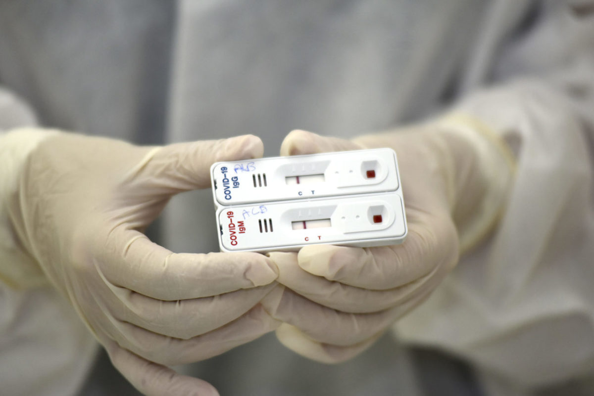 Jundiaí anuncia 450 testes rápidos ao dia para tentar “cercar” Covid-19